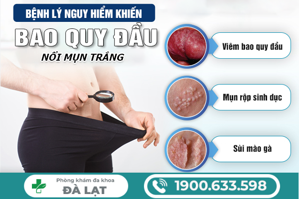 Hình ảnh minh họa